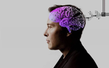 Tỷ phú Elon Musk công bố sắp cấy chip vào não người ảnh 5