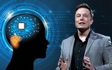 Tỷ phú Elon Musk công bố sắp cấy chip vào não người ảnh 3