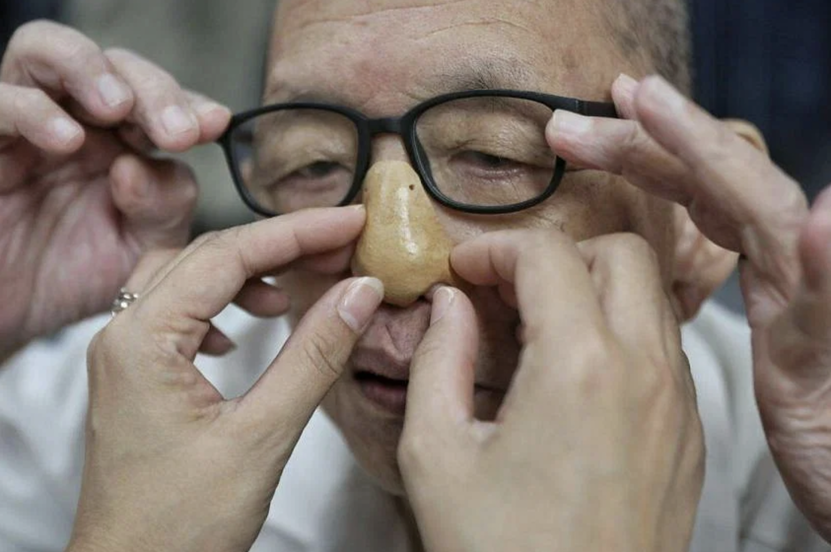 Mũi in 3D dành cho các bệnh nhân ung thư ở Singapore. Ảnh: The Straits Times