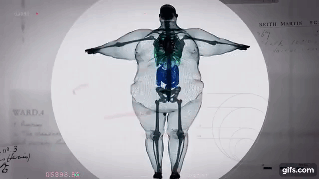 Hình ảnh mô phỏng cơ thể người đàn ông 445kg khiến bạn muốn giảm cân ngay lập tức