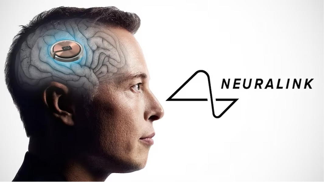 Tỷ phú Elon Musk công bố sắp cấy chip vào não người ảnh 10