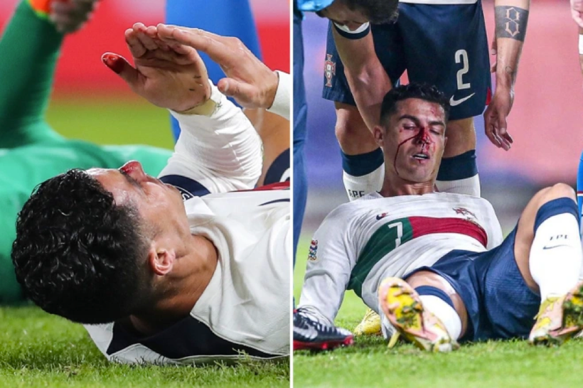 Ronaldo 'đổ máu' trong trận tuyển Bồ Đào Nha thắng đậm Czech