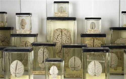 Các bộ não được bảo quản trong bình đựng formaldehyde thường được sử dụng trong các hoạt động nghiên cứu và giảng dạy. Trong ảnh là mẫu vật được trưng bày trong một bảo tàng ở London, Anh