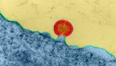 Virus HIV trong mô bạch huyết của người. Ảnh: Corbis