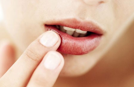 Bạn không nên lấy tay để gỡ những mảng da trên môi.
