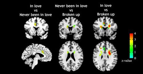 Ảnh chụp cộng hưởng từ và so sánh hoạt động của bộ não với ba nhóm: đang yêu (trên, từ trái sang) và chưa bao giờ yêu (dưới, từ trái sang), chưa bao giờ yêu và đã chia tay, đang yêu và đã chia tay. Ảnh: Frontiers in Human Neuroscience
