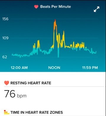 Bệnh nhân thoát chết nhờ Fitbit lưu trữ nhịp tim