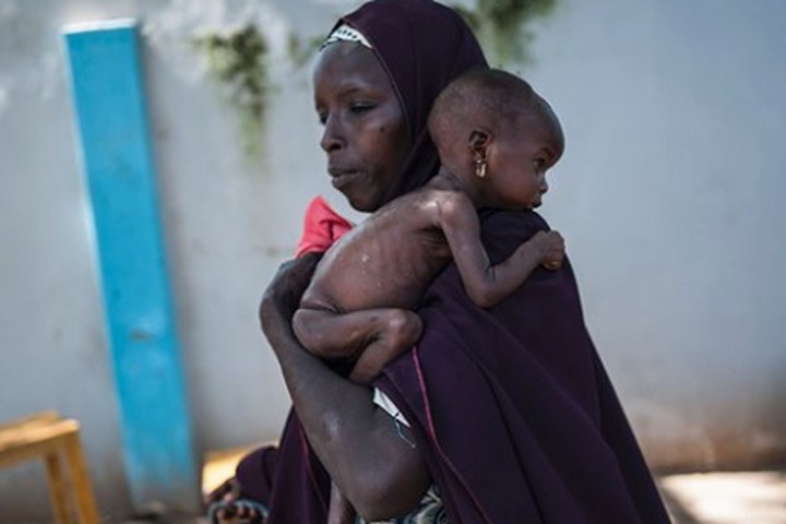 75.000 trẻ em Nigeria có nguy cơ chết đói trong vài tháng tới