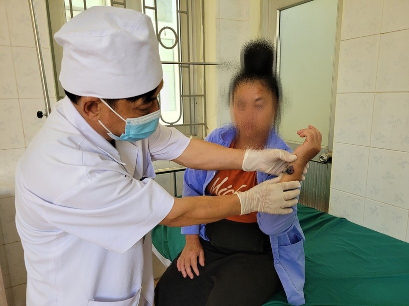Bác sĩ Trung tâm Y tế huyện Tủa Chùa thăm khám cho bệnh nhân mắc bệnh than.