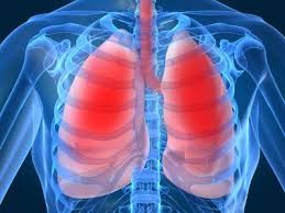 Chất độc hại cần tránh xa để tránh ung thư phổi