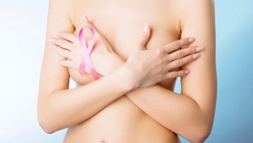 16.000 phụ nữ được sàng lọc ung thư vú