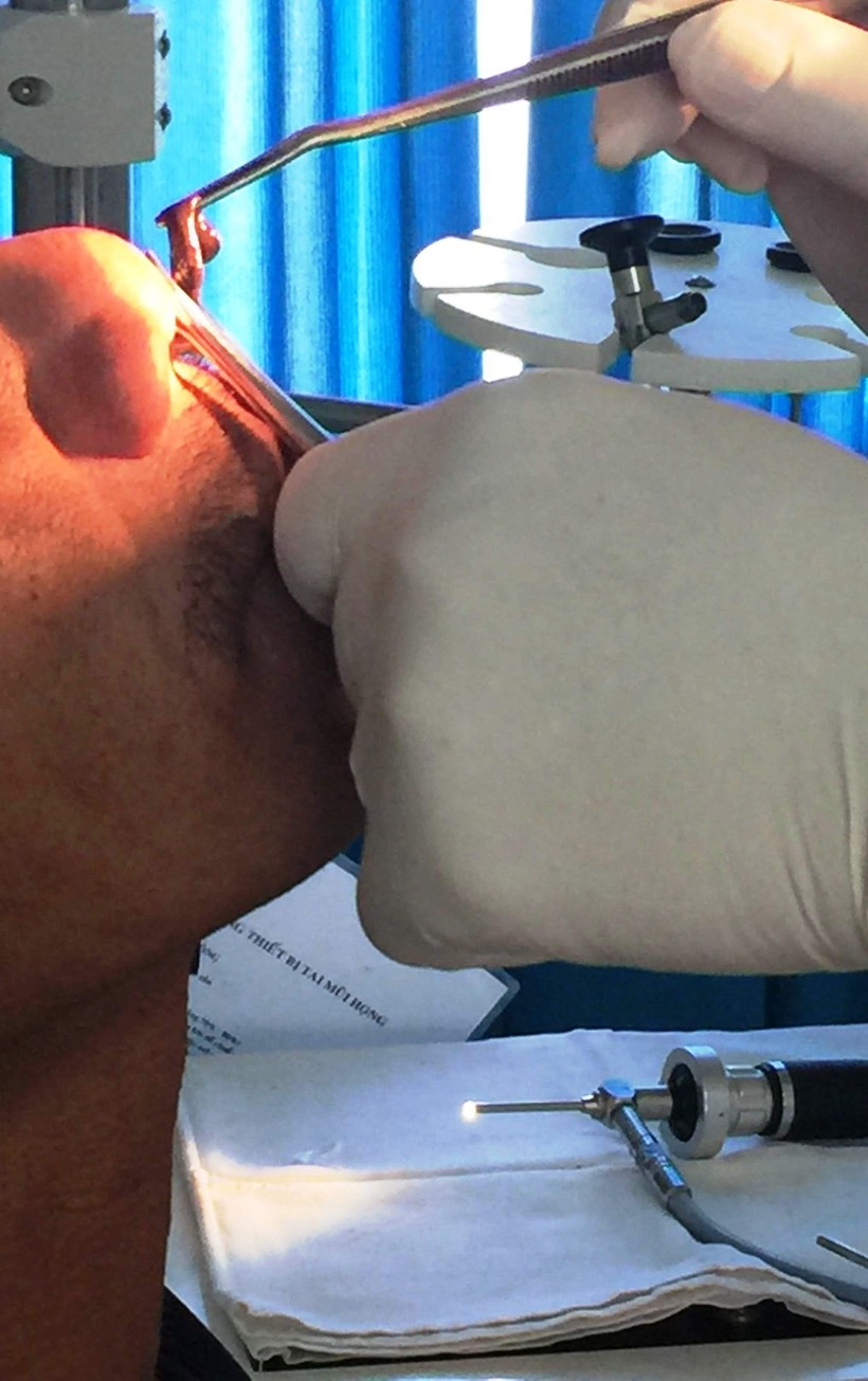 Gắp đỉa ra khỏi mũi bệnh nhân quê ở Ninh Thuận