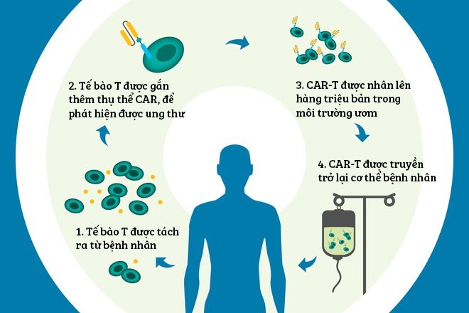 Quy trình liệu pháp gây độc tế bào ung thư bằng CART-cell.