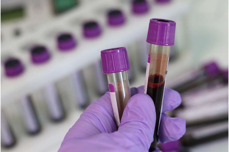Phương pháp mới có thể đưa ra một bức tranh toàn diện hơn về PFAS trong máu.