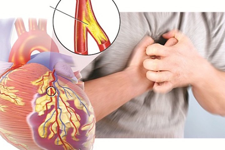 Phát hiện sớm dấu hiệu bệnh tim mạch