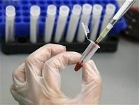 Thử nghiệm thành công loại vắc-xin đầu tiên ngăn ngừa sự lây nhiễm HIV/AIDS