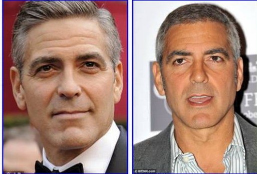 George Clooney phẫu thuật thẩm mỹ?