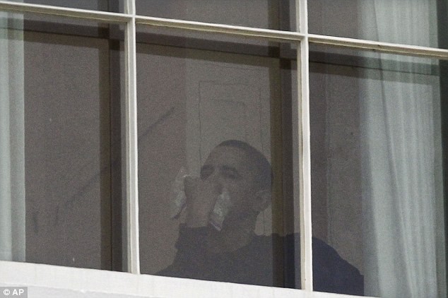 Tổng thống Obama phải khâu 12 mũi vì… nhận &quot;cùi trỏ&quot;