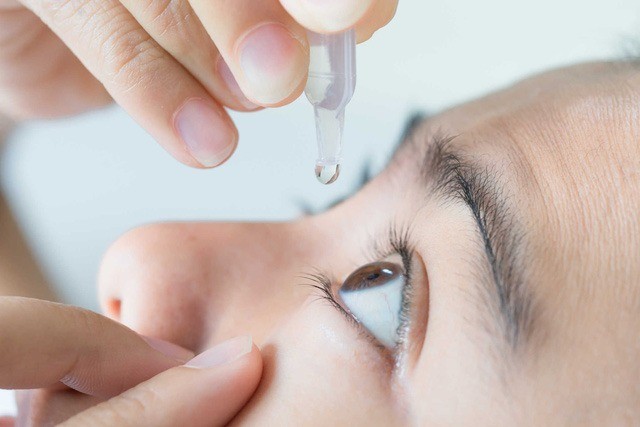 Lạm dụng thuốc nhỏ mắt chứa corticoid gây ra bệnh glaucoma.