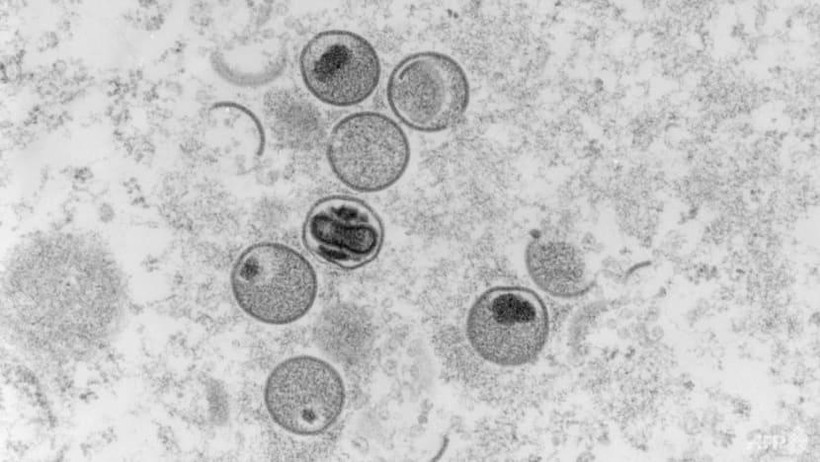 Hình chụp kính hiển vi điện tử cho thấy mặt cắt siêu mỏng của virus đậu mùa khỉ. Ảnh: AFP.