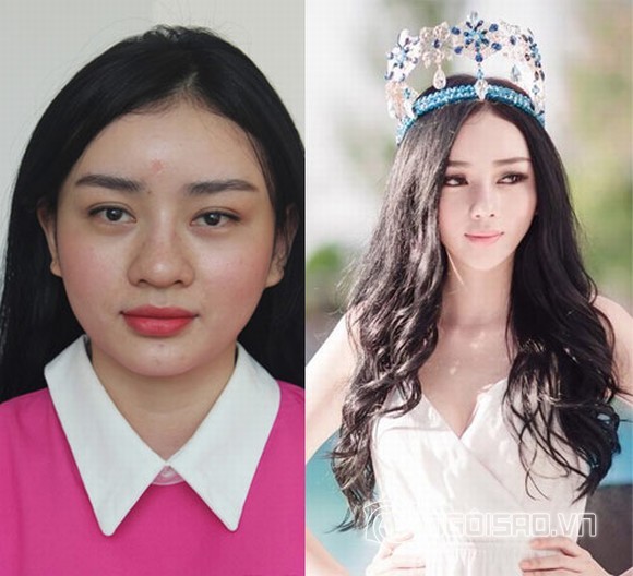 Những cô gái Việt vô danh nổi tiếng nhờ ""nghiện dao kéo""