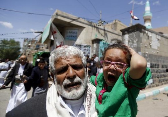 Bé gái bị thương sau vụ nổ bom tự sát nhiều người thương vong ở Yemen. Ảnh: Reuters