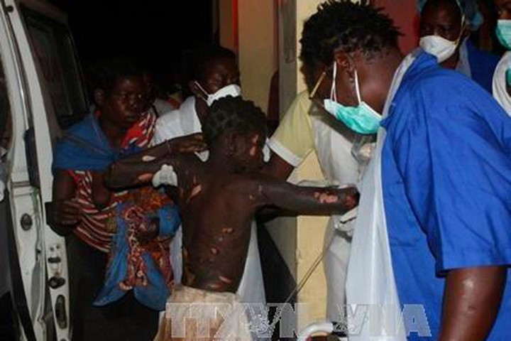 Một nạn nhân bị thương trong vụ nổ xe bồn được điều trị tại bệnh viện ở Tele ngày 17/11. Ảnh: AFP/TTXVN
