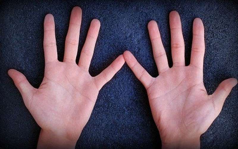 Bàn tay có nhiều vân thẳng cho thấy cuộc sống phía trước của bạn cũng không gặp nhiều may mắn - Ảnh: Minh họa