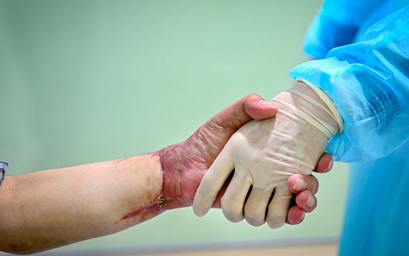 Cuộc sống mới của người đàn ông Việt Nam đầu tiên được ghép tay