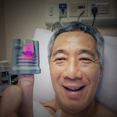 Ca phẫu thuật của thủ tướng Singapore có robot hỗ trợ