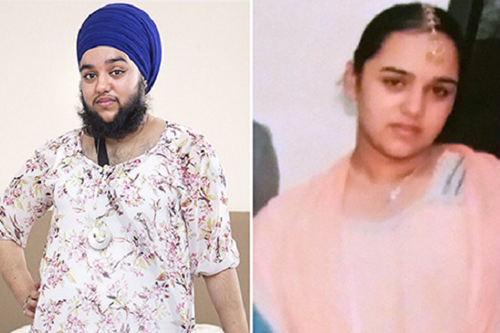Harnaam Kaur trước và sau khi nuôi râu. Ảnh: Mirror