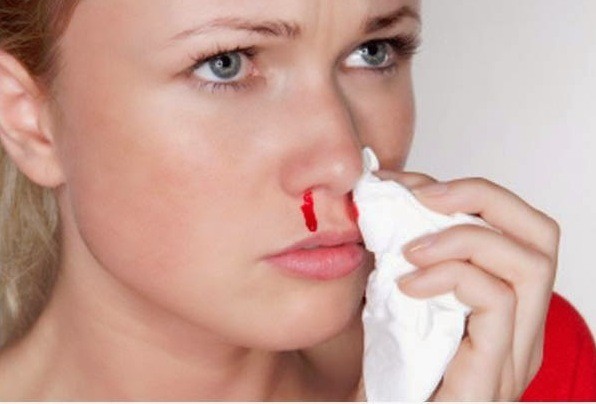 Nếu mũi xuất hiện 4 dấu hiệu lạ này chứng tỏ sức khỏe của bạn đang có vấn đề, đừng chủ quan