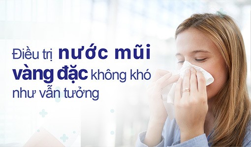 Có nhiều cách điều trị nước mũi vàng đặc mà không cần dùng thuốc kháng sinh.