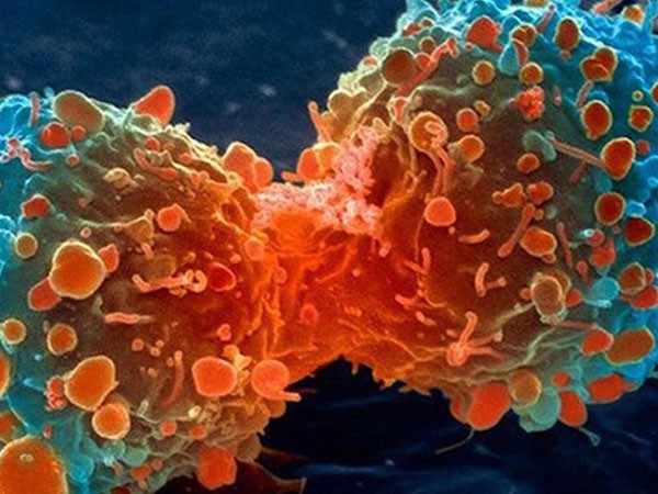 Tế bào ung thư tấn công cả những người có lối sống lành mạnh.