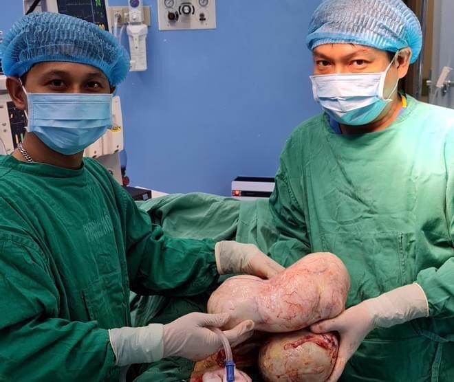 Các bác sỹ đã phẫu thuật, lấy thành công khối u nặng hơn 6kg.