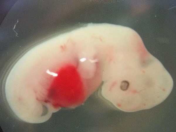 Hình ảnh phôi lợn được cấy tế bào con người. (Nguồn: National Geographic).