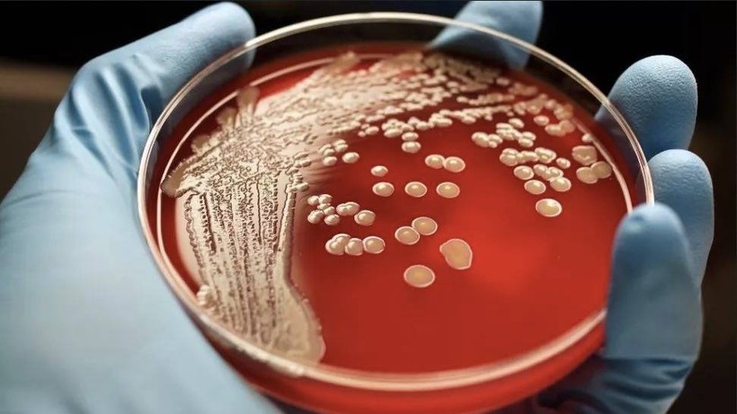 Vi khuẩn Staphylococcus aureus kháng thuốc.
