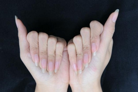 Móng tay của phụ nữ quá dài có thể gây ra các bệnh phụ khoa?
