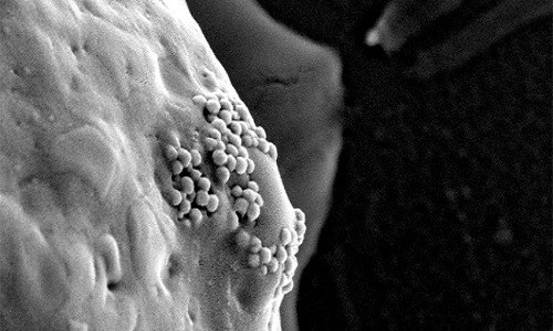 Các hạt nano vàng bám trên bề mặt tế bào ung thư. Ảnh: D. S. Wagner.
