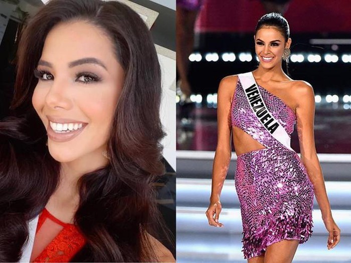 Nhan sắc gây tranh cãi của người đẹp vừa đăng quang Hoa hậu Venezuela