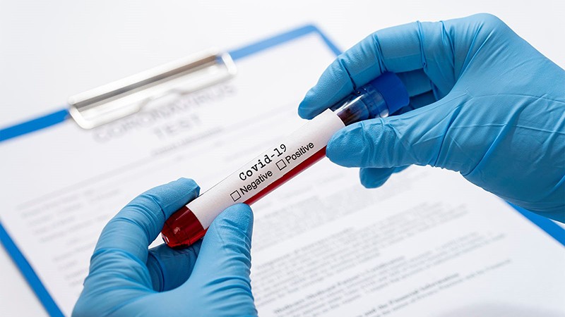 Hiện có 38 người tiếp xúc gần với ca nhiễm SARS-CoV-2 được lấy mẫu xét nghiệm (Ảnh:IT)