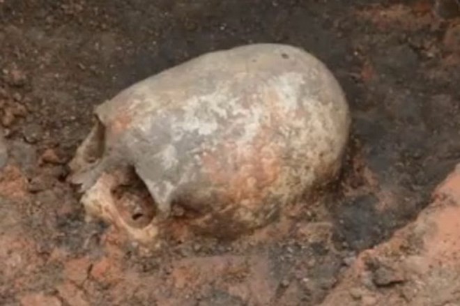 Chiếc hộp sọ hình quả trứng tìm thấy ở Nga. (Nguồn: Mirror)