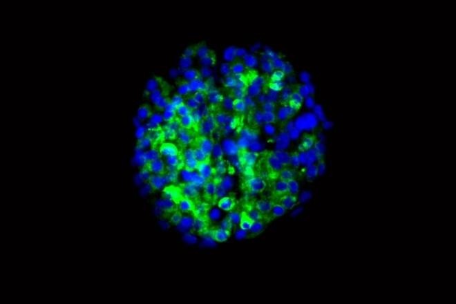 Tế bào Beta có nguồn gốc từ tế bào gốc, mang khả năng sản sinh ra insulin. Ảnh: Medicaldaily