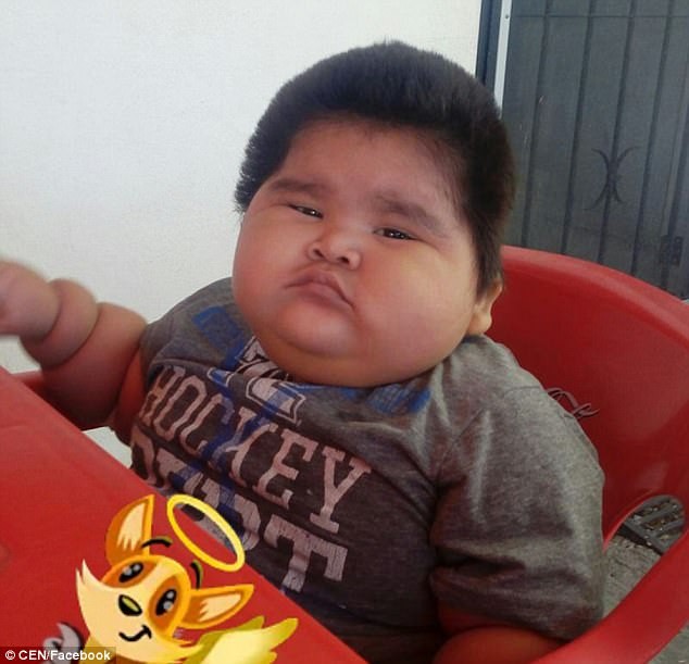 10 tháng, nặng 30kg – cậu bé Mexico liên tục đói bụng