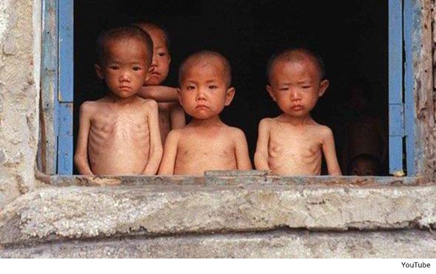 Nhiều trẻ em Triều Tiên bị suy dinh dưỡng (Ảnh: thefiscaltimes)