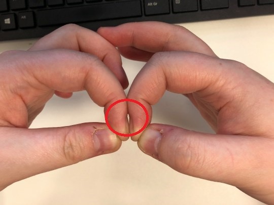 Người không có triệu chứng ung thư phổi sẽ có khoảng trống hình kim cương giữa 2 ngón tay trỏ.