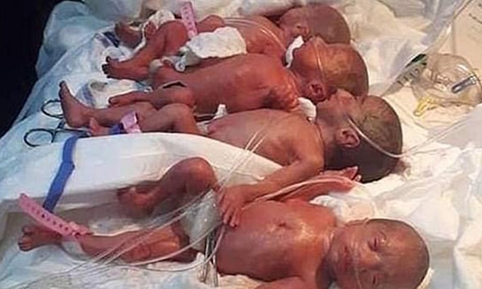 9 em bé đã chào đời sau một ca sinh mổ.