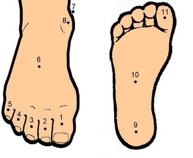 Nốt ruồi bàn chân có ý nghĩa gì?
