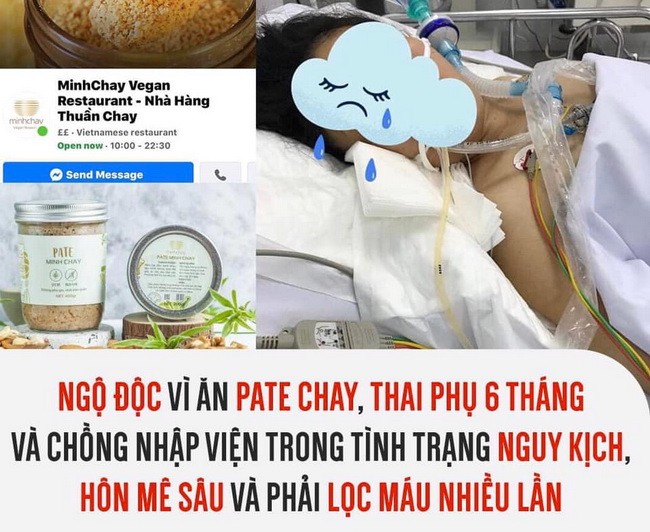 Bệnh nhân bị ngộ độc do ăn pate Chay. (Ảnh: IT).