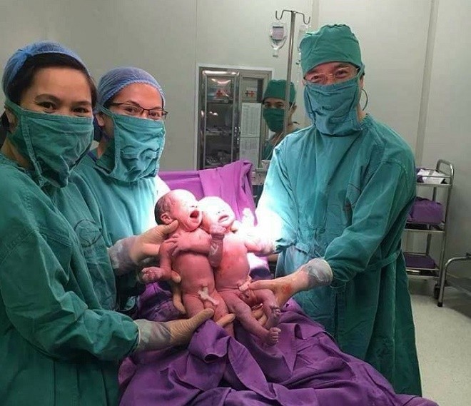 Hai bé trai sinh đôi đầu tiên ra đời nhờ thụ tinh ống nghiệm IVF tại bệnh viện Sản Nhi Quảng Ninh